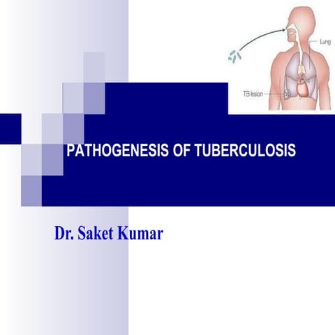 tuberculosis .pptx