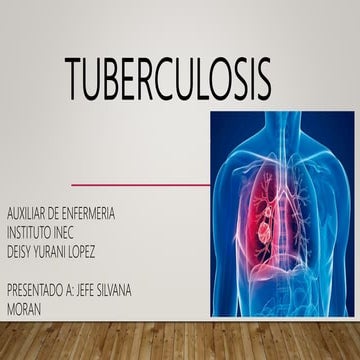 PRESENTACION POWER POINT DE TUBERCULOSIS | PPTX