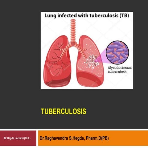 Tuberculosis 