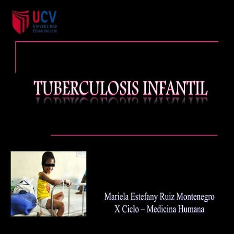 Tuberculosis infantil