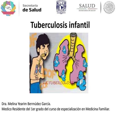 Tuberculosis infantil