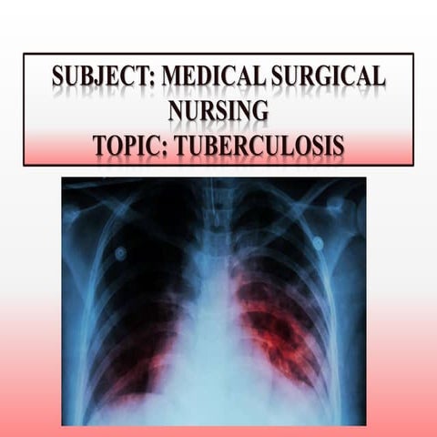 PULMONARY TUBERCULOSIS SLIDESHARE | PPTX