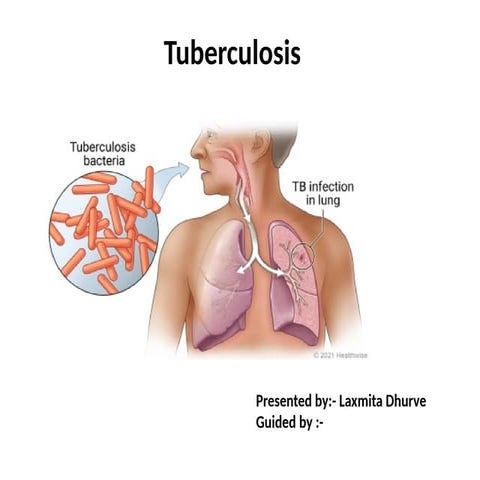 Tuberculosis_Presentation.pptx _165#':!+ | PPTX