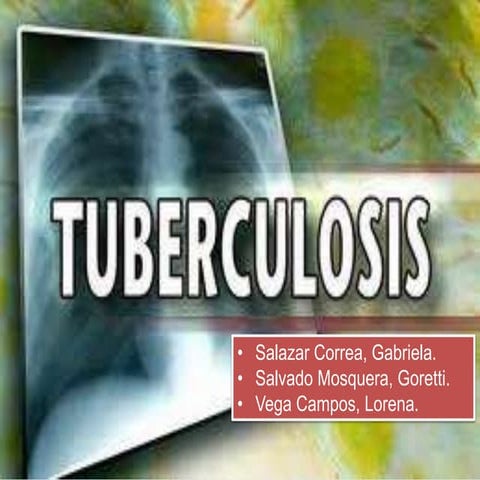 Tuberculosis pulmonar
