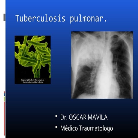 TUBERCULOSIS II