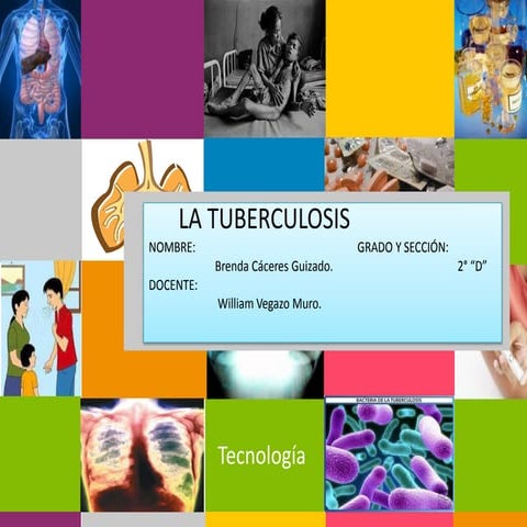 Tuberculosis | PPTX