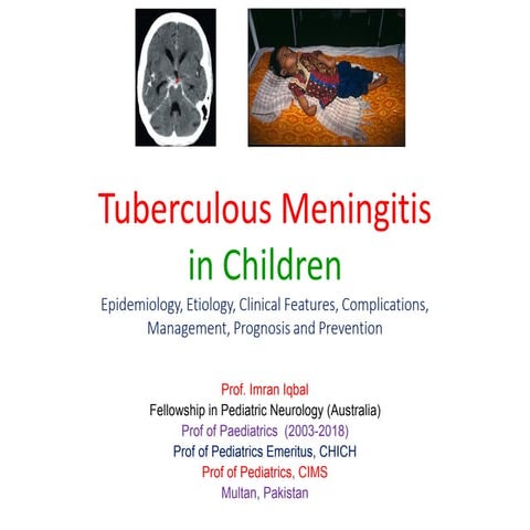 Tuberculous meningitis in children 2021