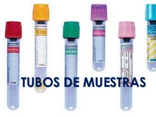 Tubos de muestra