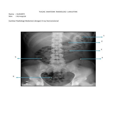 Tugas Anatomi Radiologi 3