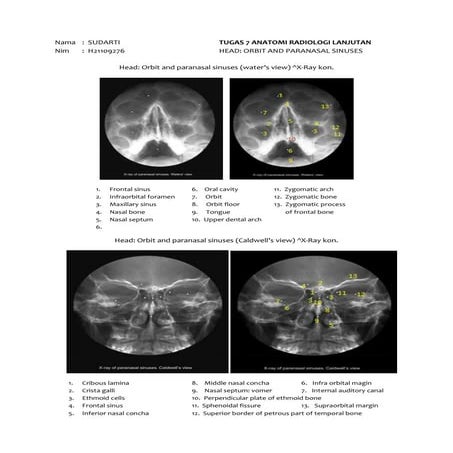 Tugas anatomi Radiologi 7