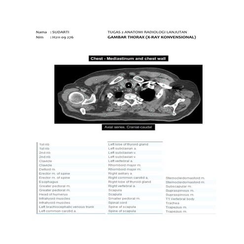 Tugas Anatomi Radiologi 2