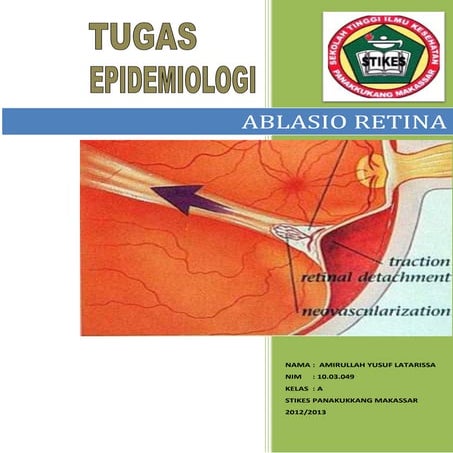 Tugas epidemologi   ablasio retina