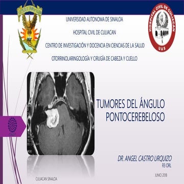 Tumores del angulo pontocerebeloso