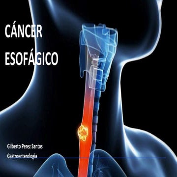 Cancer-de-esofago-concepto-fisiologia-y-anatomia.pptx