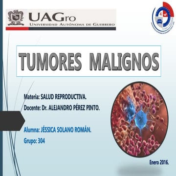 Tumores Malignos