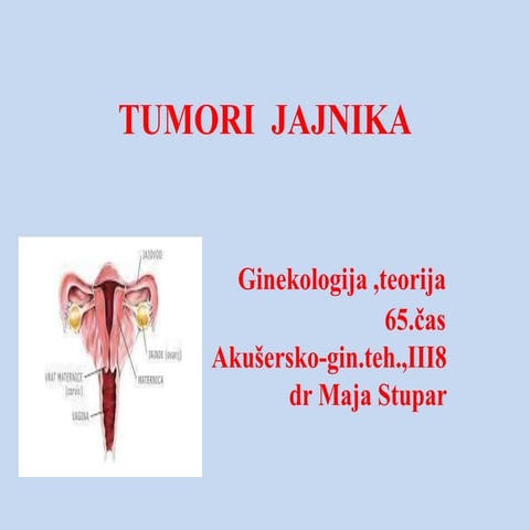 Tumori Jajnika Pptx