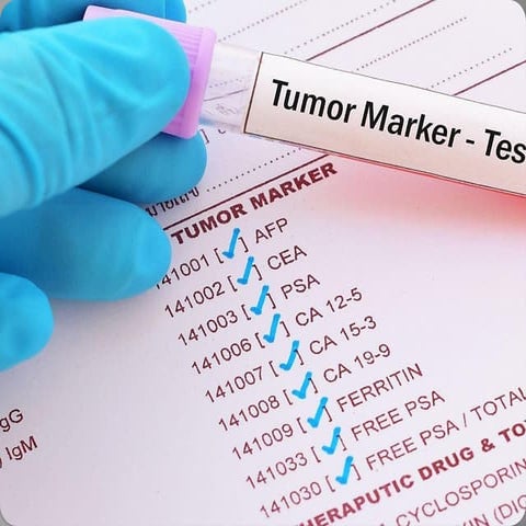 Tumor markers Lecture      2_094740.pptx