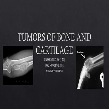 Tumors of bone | PPTX