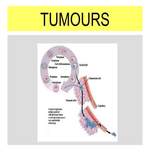 Tumours