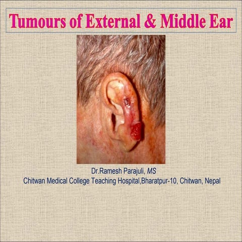 Tumours of external and middle ear