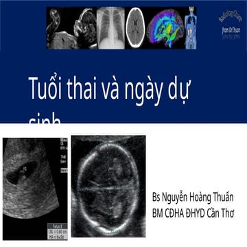 Tuoi thai - ngay du sinh ver 2.0qưe.pptx