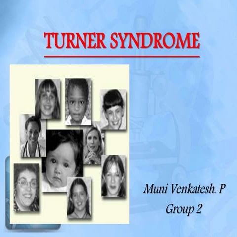 Turner's syndrome