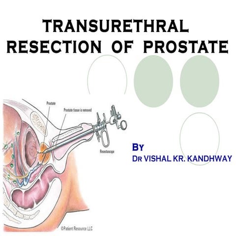 TURP step by step operative urology | PDF