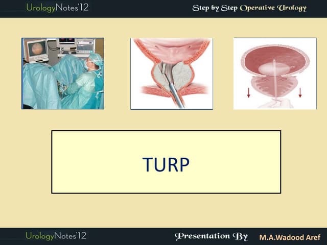 Supra pubic cystostomy | PPTX