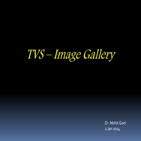 Tvs image gallery
