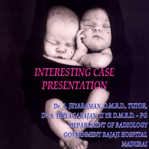 Twin Embolization Syndrome