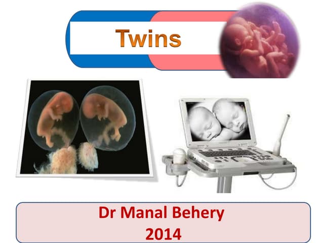 Twins for undergraduate | PPT