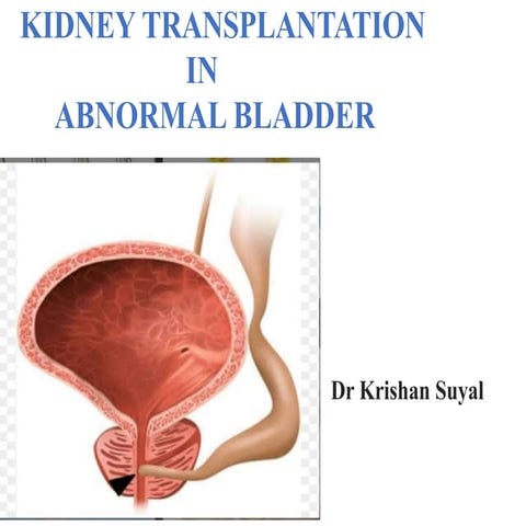 TX in Abnormal bladder.pptx ghfdggoibgf ffghhj | PPTX