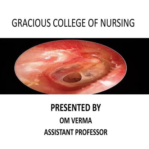 tympanic membrane perforation.pdf