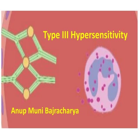 Type III Hypersensitivity