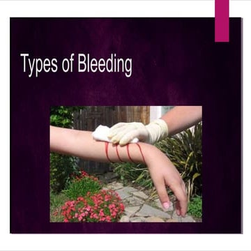 Types of bleeding ppt