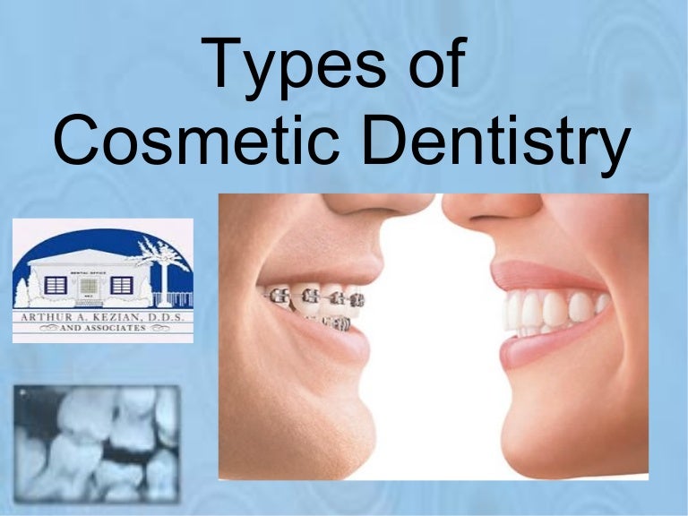 Types of cosmetic dentistry