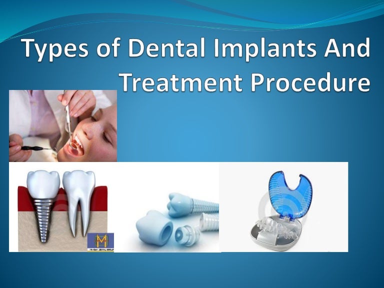 Types of dental implant and treatment procedure