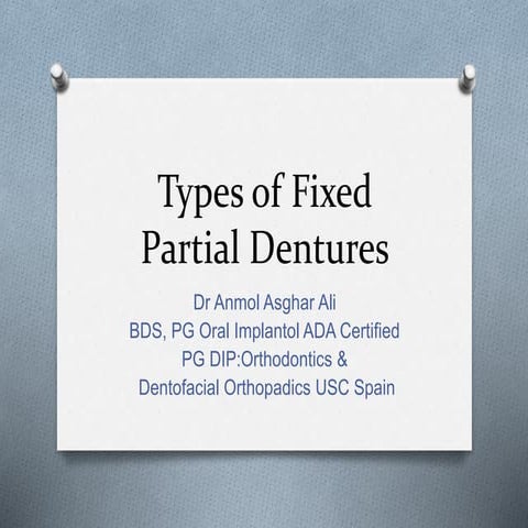 Types of Fixed Partial Dentures for BDS.
