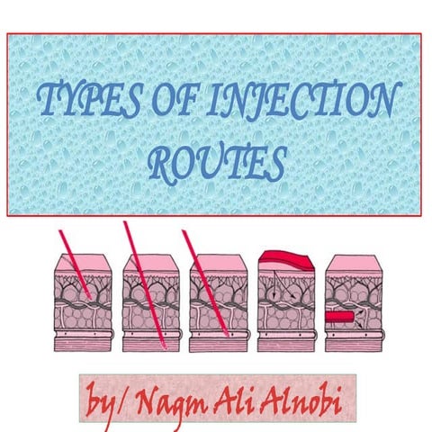 Parenteral Routes of Drug Administration: IM, IV, ID, and SC Injections ...