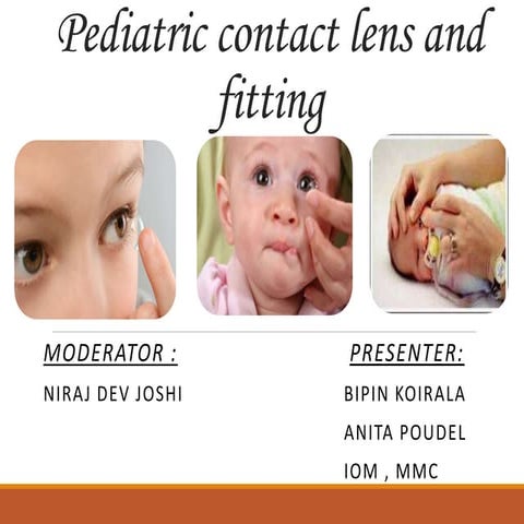 Types of pediatric contact lens [autosaved]