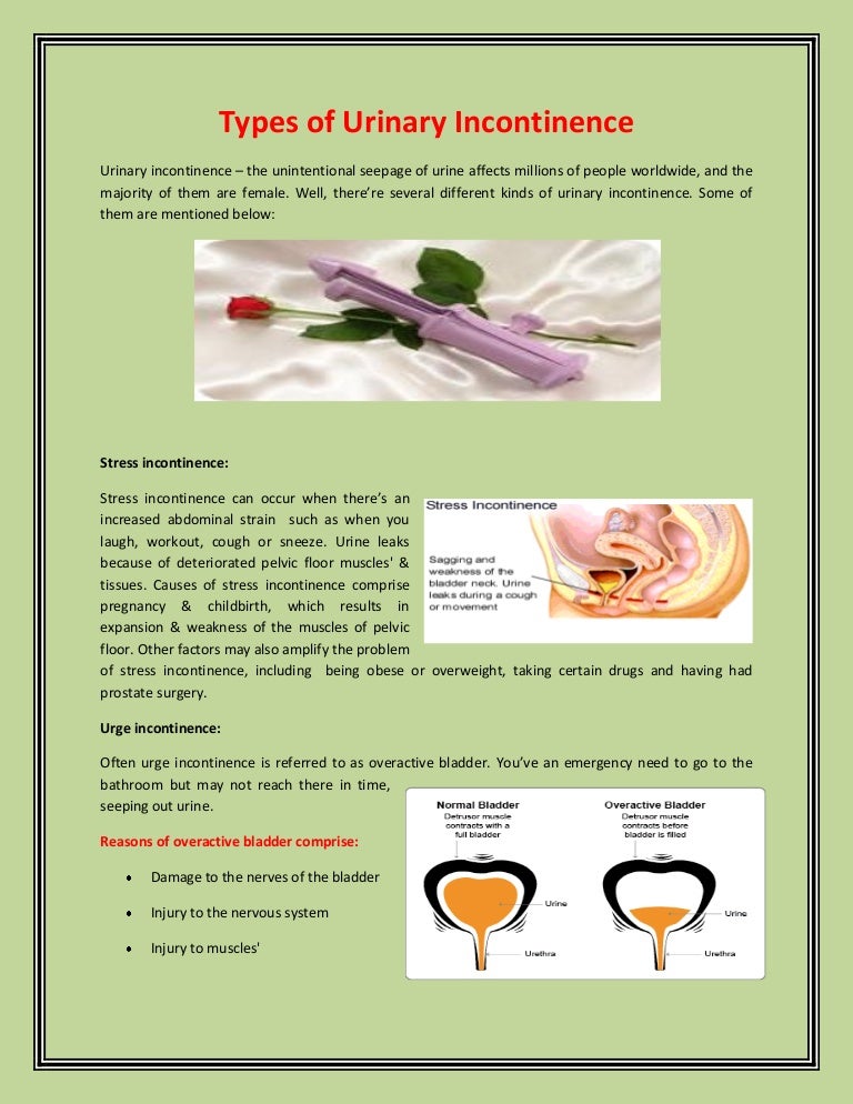 Types of Urinary Incontinence