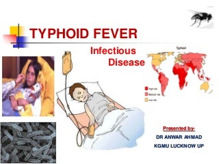 Typhoid fever ppt