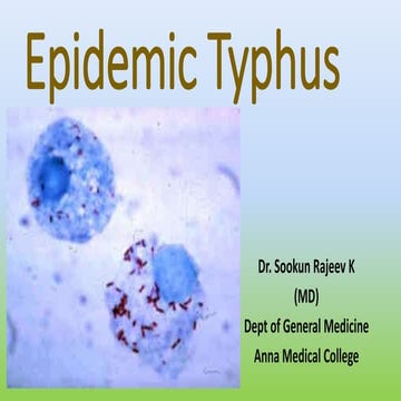 Typhus Fever by Dr. Sookun Rajeev Kumar