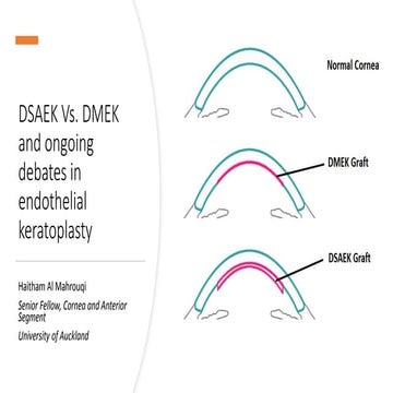 DSAEK VS. DMEK.pptx