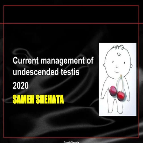 Undescended testis , Guidelines for managment