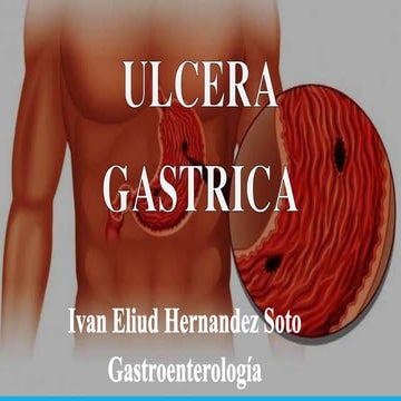 Ulcera gastrica