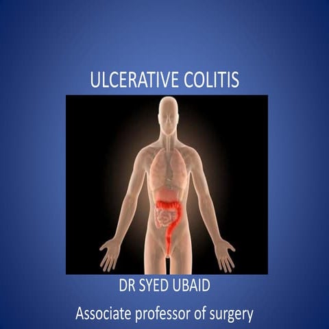 Ulcerative colitis