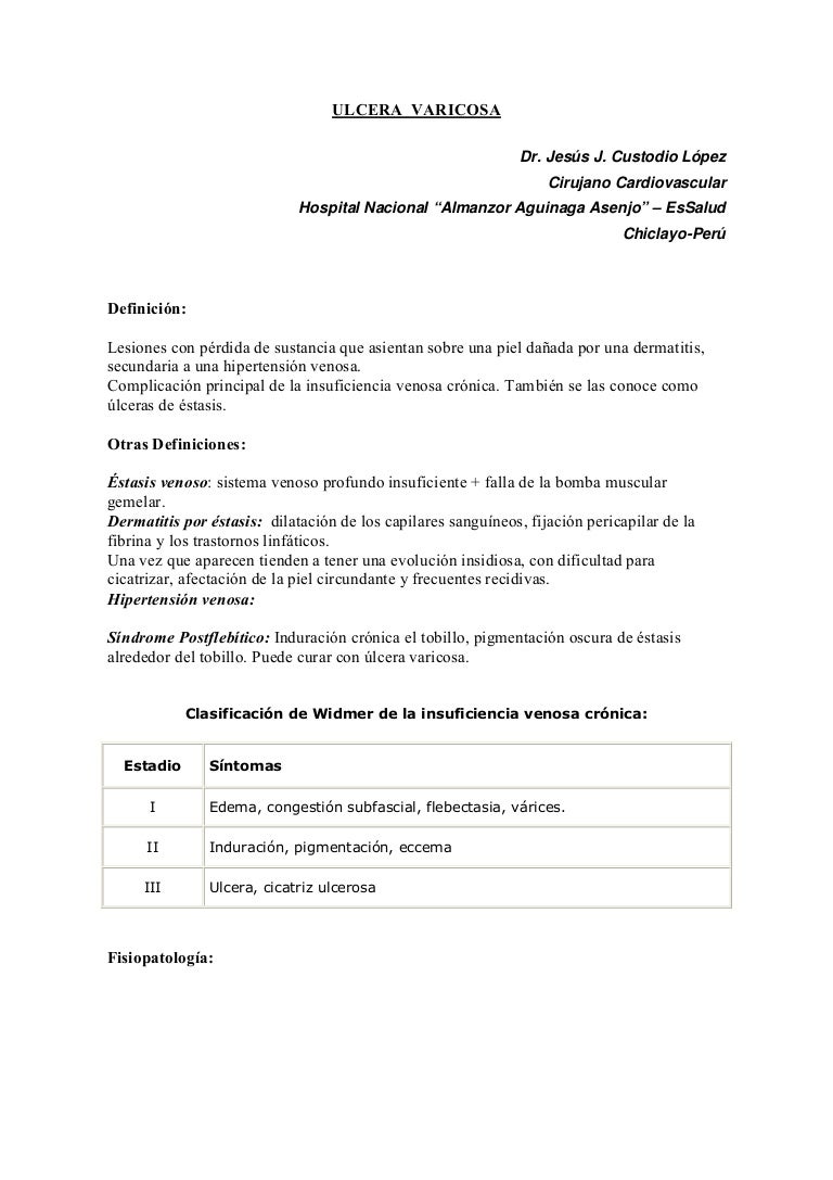 discul varicos