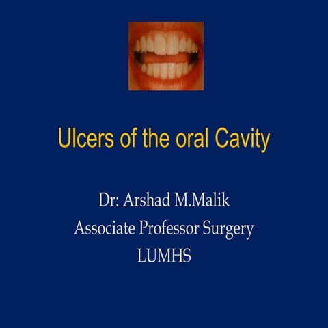 Ulcers of the oral Cavity Arshad.pptx