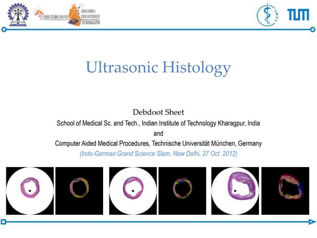 Ultrasonic Histology
